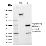 SDS-PAGE - Anti-IL2 Receptor alpha Antibody [IL2RA/2395] - BSA and Azide free (A252198) - Antibodies.com