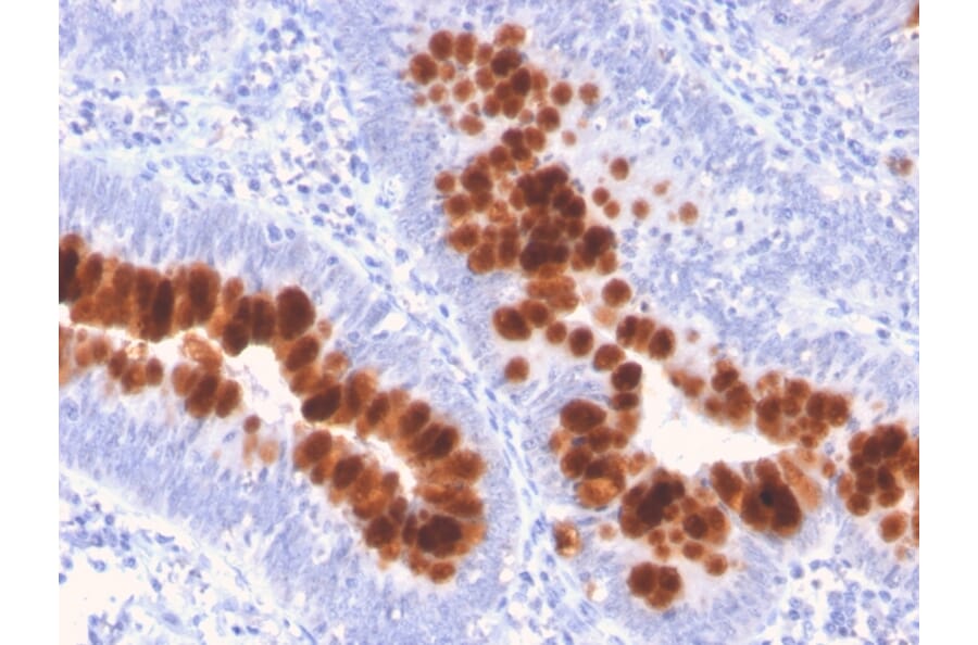 Immunohistochemistry - Anti-Fas Antibody [FAS/3112] - BSA and Azide free (A252200) - Antibodies.com