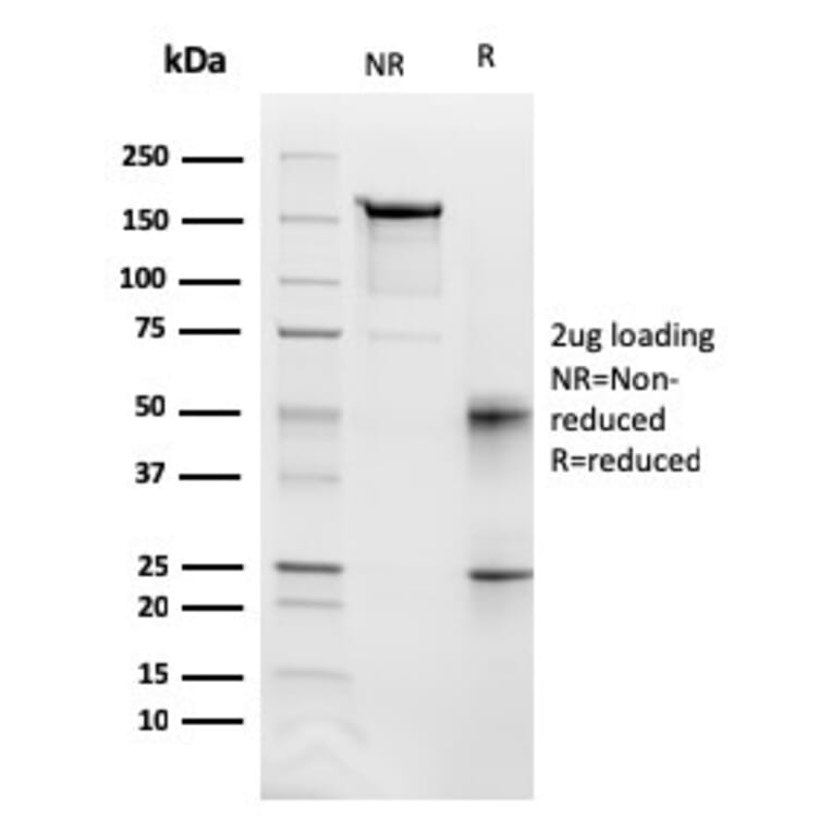 SDS-PAGE - Anti-Fas Antibody [FAS/3112] - BSA and Azide free (A252200) - Antibodies.com