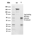 SDS-PAGE - Anti-Fas Antibody [FAS/3112] - BSA and Azide free (A252200) - Antibodies.com