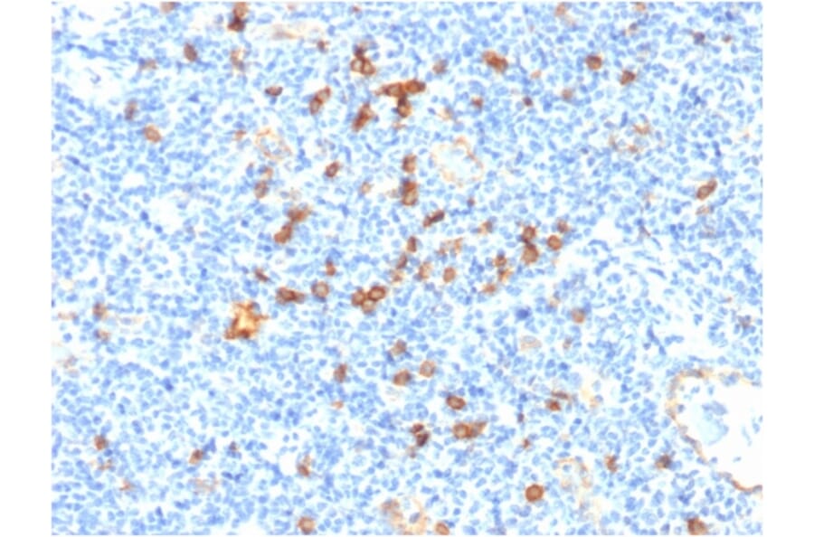 Immunohistochemistry - Anti-IL3RA Antibody [IL3RA/1531] - BSA and Azide free (A252202) - Antibodies.com