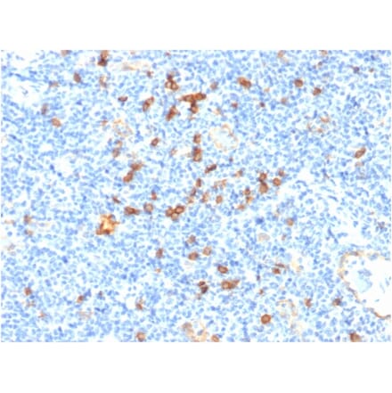 Immunohistochemistry - Anti-IL3RA Antibody [IL3RA/1531] - BSA and Azide free (A252202) - Antibodies.com