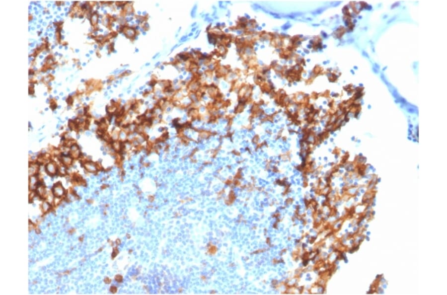 Immunohistochemistry - Anti-IL3RA Antibody [IL3RA/1531] - BSA and Azide free (A252202) - Antibodies.com