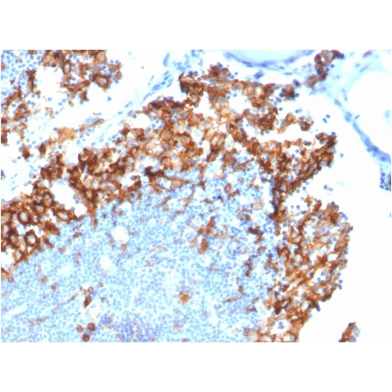 Immunohistochemistry - Anti-IL3RA Antibody [IL3RA/1531] - BSA and Azide free (A252202) - Antibodies.com