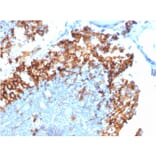 Immunohistochemistry - Anti-IL3RA Antibody [IL3RA/1531] - BSA and Azide free (A252202) - Antibodies.com