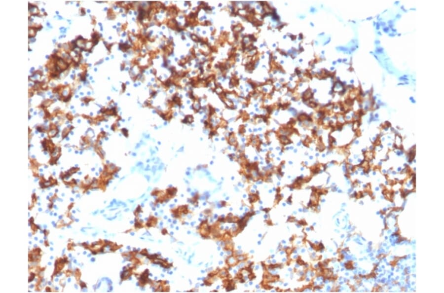 Immunohistochemistry - Anti-IL3RA Antibody [IL3RA/1531] - BSA and Azide free (A252202) - Antibodies.com