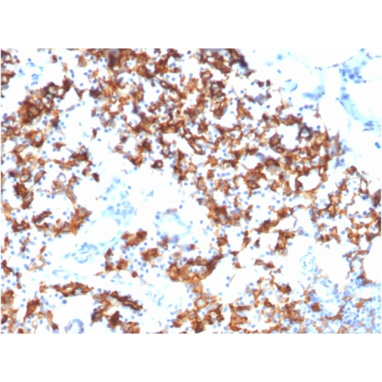 Immunohistochemistry - Anti-IL3RA Antibody [IL3RA/1531] - BSA and Azide free (A252202) - Antibodies.com