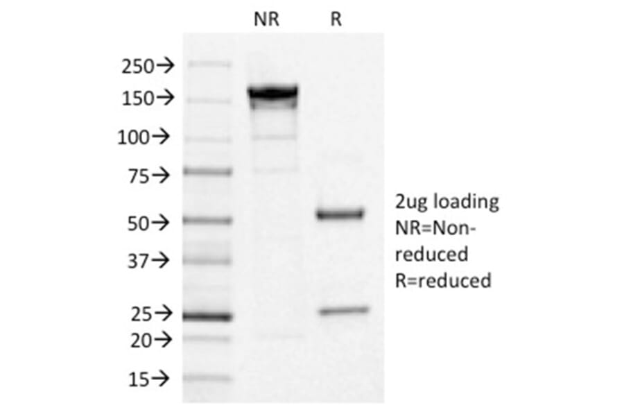 SDS-PAGE - Anti-IL3RA Antibody [IL3RA/1531] - BSA and Azide free (A252202) - Antibodies.com