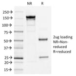 SDS-PAGE - Anti-IL3RA Antibody [IL3RA/1531] - BSA and Azide free (A252202) - Antibodies.com