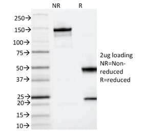 SDS-PAGE - Anti-IL3RA Antibody [IL3RA/2065] - BSA and Azide free (A252203) - Antibodies.com
