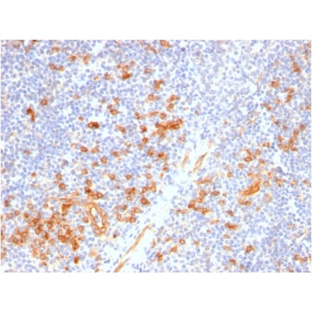 Immunohistochemistry - Anti-IL3RA Antibody [IL3RA/2947R] - BSA and Azide free (A252204) - Antibodies.com