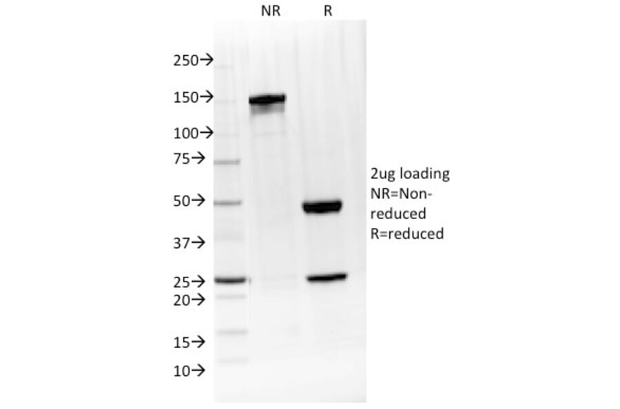 SDS-PAGE - Anti-IL-4 Antibody [IL4/1597] - BSA and Azide free (A252204) - Antibodies.com