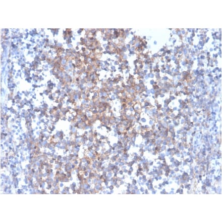 Immunohistochemistry - Anti-Fas Ligand Antibody [FASLG/4455] - BSA and Azide free (A252206) - Antibodies.com
