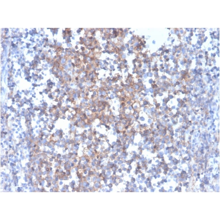 Immunohistochemistry - Anti-Fas Ligand Antibody [FASLG/4455] - BSA and Azide free (A252206) - Antibodies.com