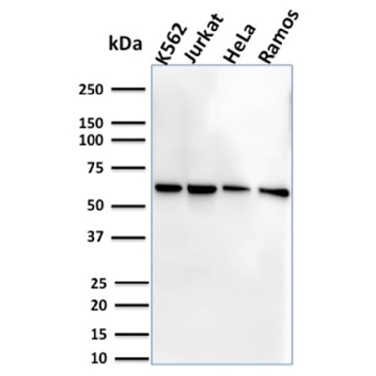 Western Blot - Anti-CD127 Antibody [IL7R/2751] - BSA and Azide free (A252207) - Antibodies.com