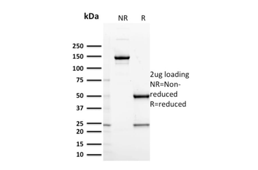 SDS-PAGE - Anti-CD127 Antibody [IL7R/2751] - BSA and Azide free (A252207) - Antibodies.com