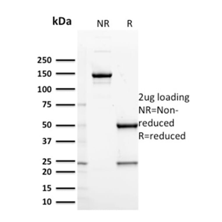 SDS-PAGE - Anti-CD127 Antibody [IL7R/2751] - BSA and Azide free (A252207) - Antibodies.com