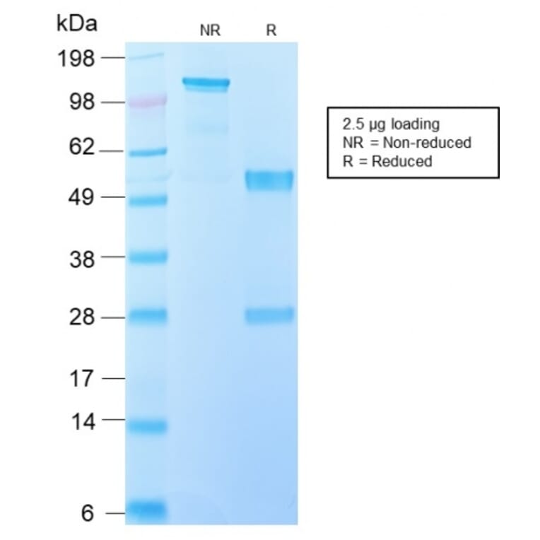 SDS-PAGE - Anti-IL-10 Antibody [IL10/2651R] - BSA and Azide free (A252208) - Antibodies.com