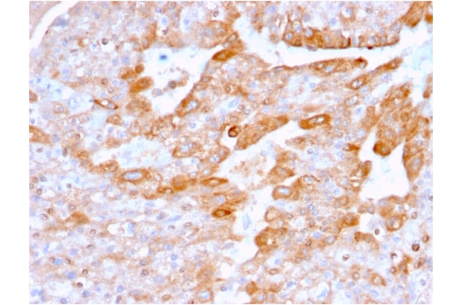 Immunohistochemistry - Anti-CD137 Antibody [4-1BB/3201] - BSA and Azide free (A252209) - Antibodies.com