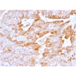 Immunohistochemistry - Anti-CD137 Antibody [4-1BB/3201] - BSA and Azide free (A252209) - Antibodies.com