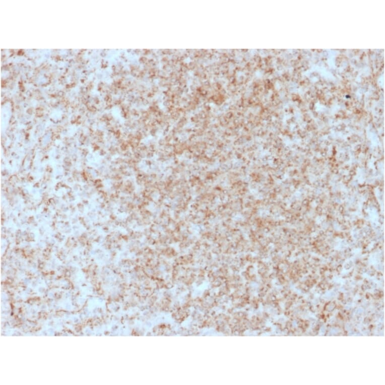 Immunohistochemistry - Anti-CD137 Antibody [4-1BB/3201] - BSA and Azide free (A252209) - Antibodies.com