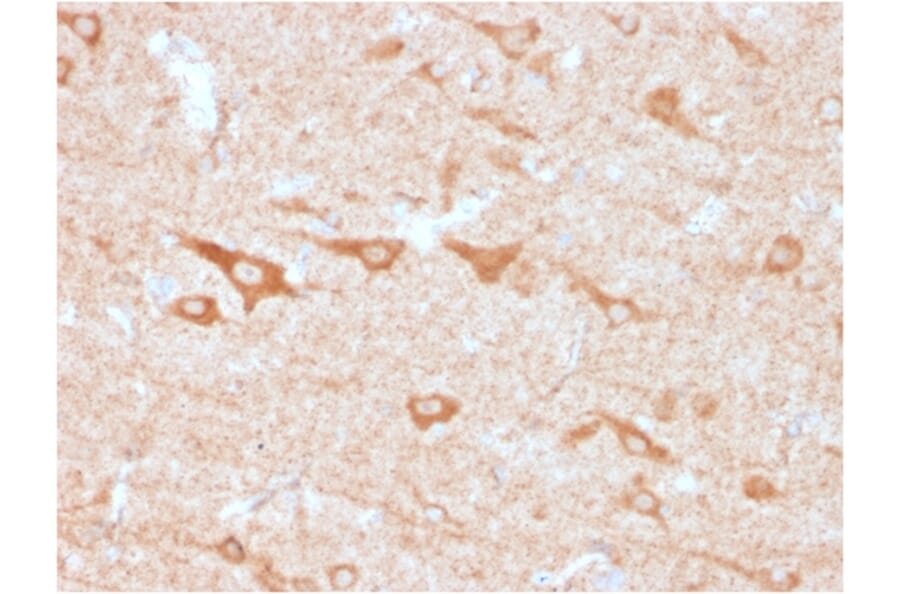 Immunohistochemistry - Anti-CD137 Antibody [4-1BB/3201] - BSA and Azide free (A252209) - Antibodies.com