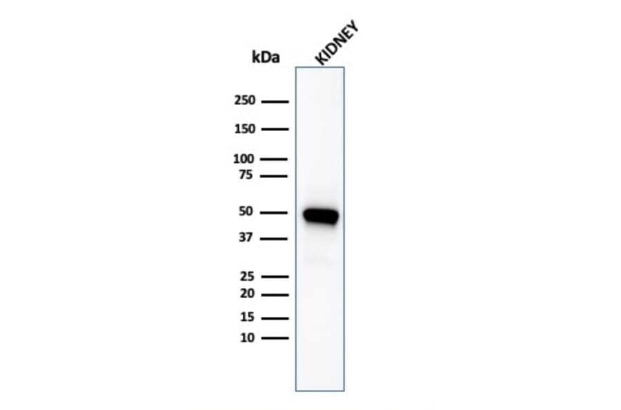 Western Blot - Anti-CD137 Antibody [4-1BB/3201] - BSA and Azide free (A252209) - Antibodies.com