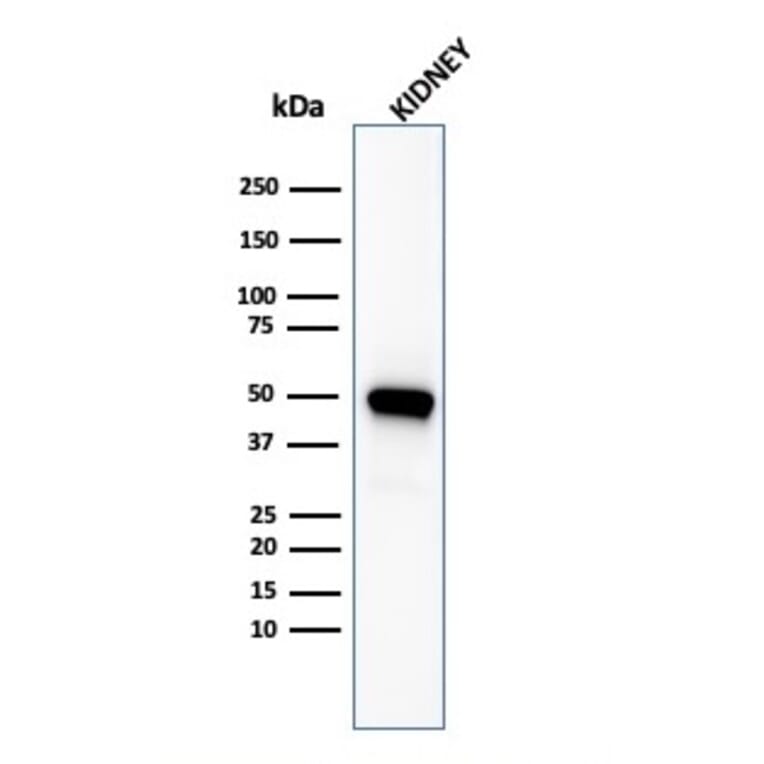 Western Blot - Anti-CD137 Antibody [4-1BB/3201] - BSA and Azide free (A252209) - Antibodies.com