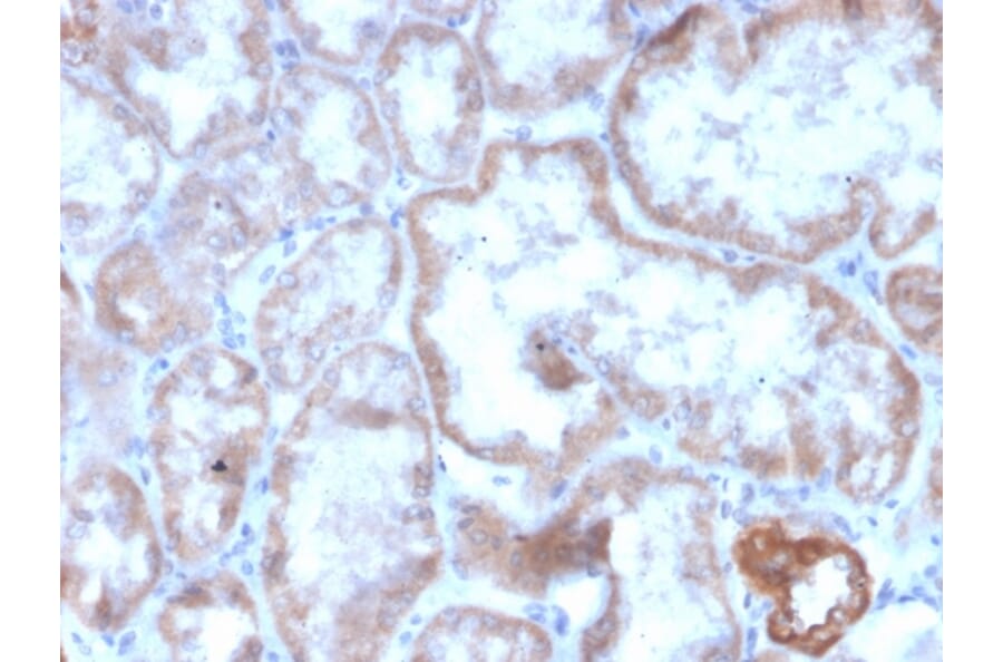 Immunohistochemistry - Anti-CD137 Antibody [r4-1BB/4603] - BSA and Azide free (A252209) - Antibodies.com