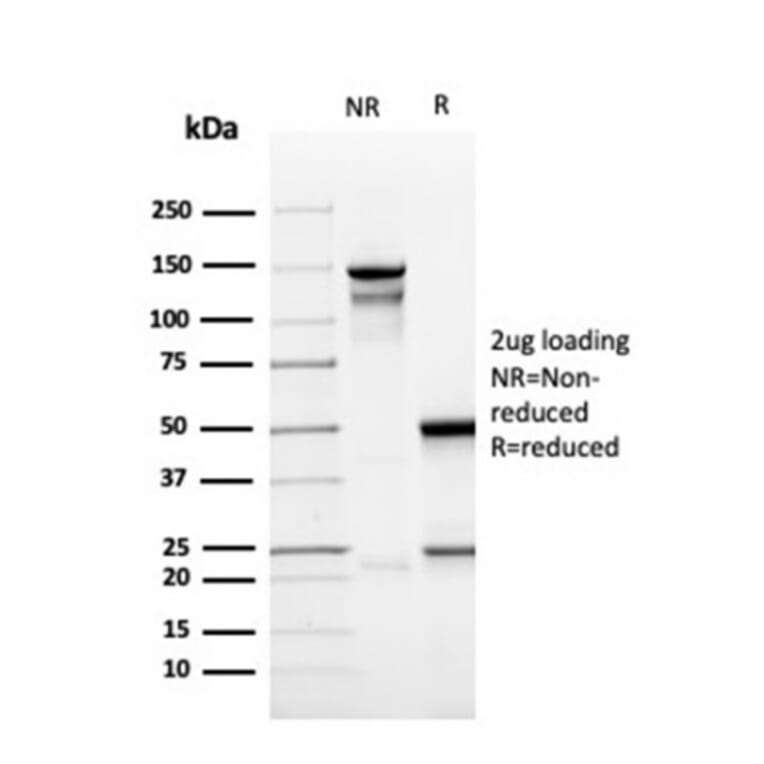SDS-PAGE - Anti-CD137 Antibody [r4-1BB/4603] - BSA and Azide free (A252210) - Antibodies.com
