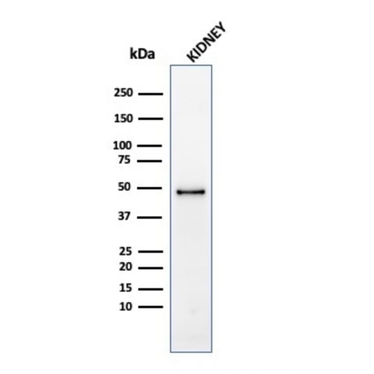 Western Blot - Anti-CD137 Antibody [4-1BB/4552R] - BSA and Azide free (A252211) - Antibodies.com