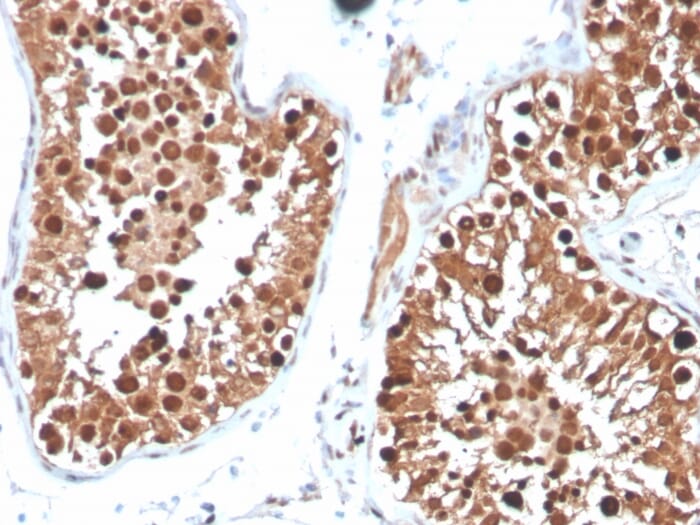 【送料無料】 Anti-Inhibin alpha Antibody [INHA/4265] (A252213 スノーボード