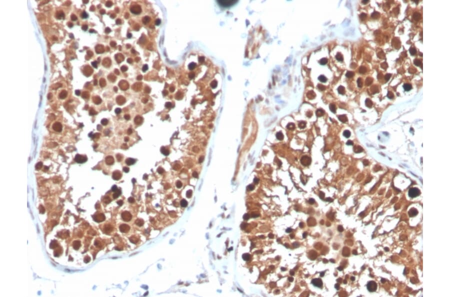 Immunohistochemistry - Anti-Inhibin alpha Antibody [INHA/4265] - BSA and Azide free (A252213) - Antibodies.com