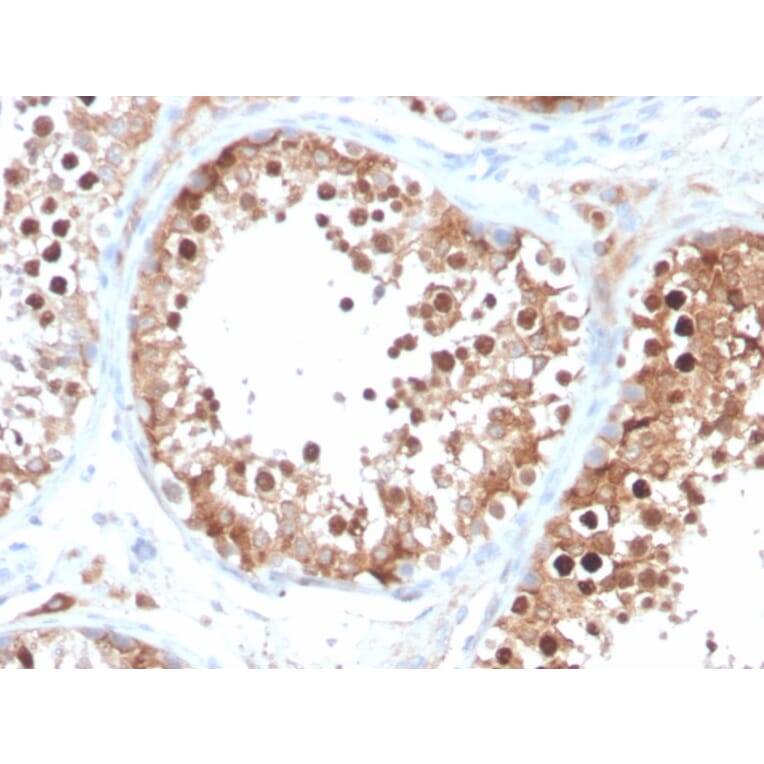 Immunohistochemistry - Anti-Inhibin alpha Antibody [INHA/4266] - BSA and Azide free (A252213) - Antibodies.com