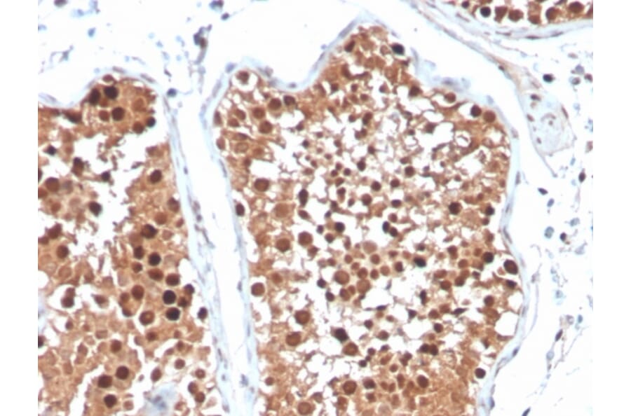 Immunohistochemistry - Anti-Inhibin alpha Antibody [R1] - BSA and Azide free (A252215) - Antibodies.com