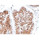 Immunohistochemistry - Anti-Inhibin alpha Antibody [R1] - BSA and Azide free (A252215) - Antibodies.com