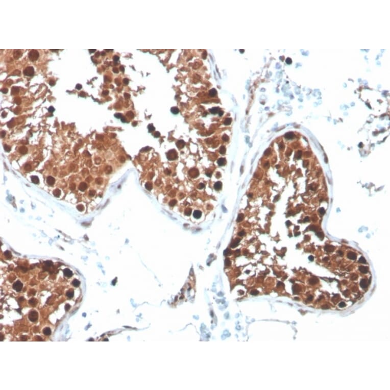 Immunohistochemistry - Anti-Inhibin alpha Antibody [R1] - BSA and Azide free (A252214) - Antibodies.com