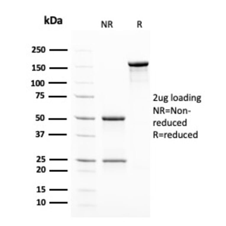 SDS-PAGE - Anti-Insulin Antibody [2D11-H5] - BSA and Azide free (A252216) - Antibodies.com