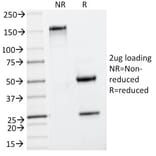 SDS-PAGE - Anti-Insulin Antibody [IRDN/794] - BSA and Azide free (A252221) - Antibodies.com