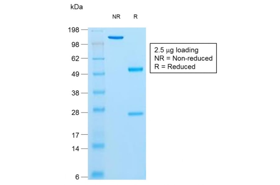 SDS-PAGE - Anti-Insulin Antibody [rIRDN/805] - BSA and Azide free (A252224) - Antibodies.com