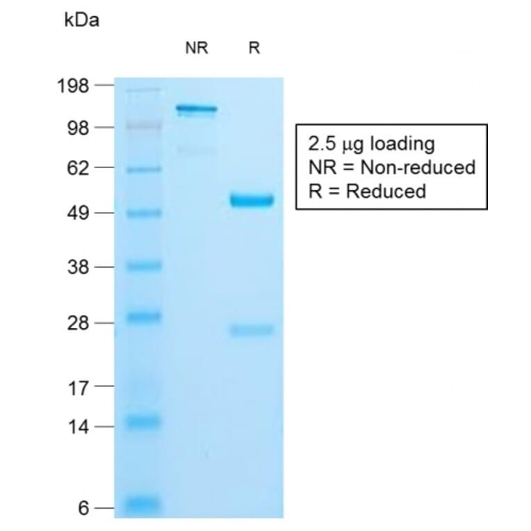 SDS-PAGE - Anti-Insulin Antibody [IRDN/1980R] - BSA and Azide free (A252225) - Antibodies.com