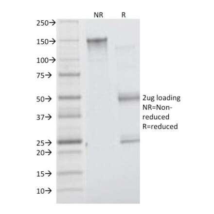 SDS-PAGE - Anti-Insulin Receptor alpha Antibody [INSR/1661] - BSA and Azide free (A252225) - Antibodies.com