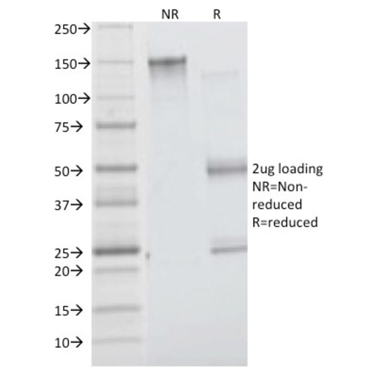 SDS-PAGE - Anti-Insulin Receptor alpha Antibody [INSR/1661] - BSA and Azide free (A252225) - Antibodies.com