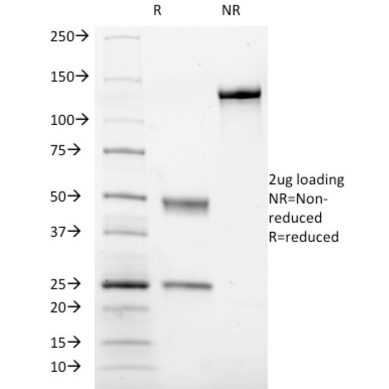 SDS-PAGE - Anti-CD41a Antibody [ITGA2B/1036] - BSA and Azide free (A252231) - Antibodies.com