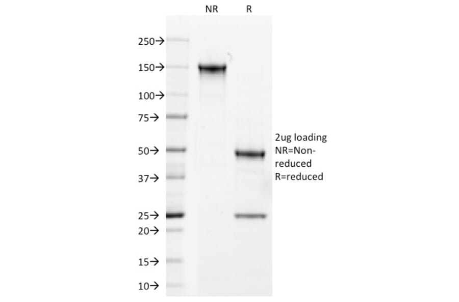 SDS-PAGE - Anti-Androgen Receptor Antibody [AR441] - BSA and Azide free (A252233) - Antibodies.com