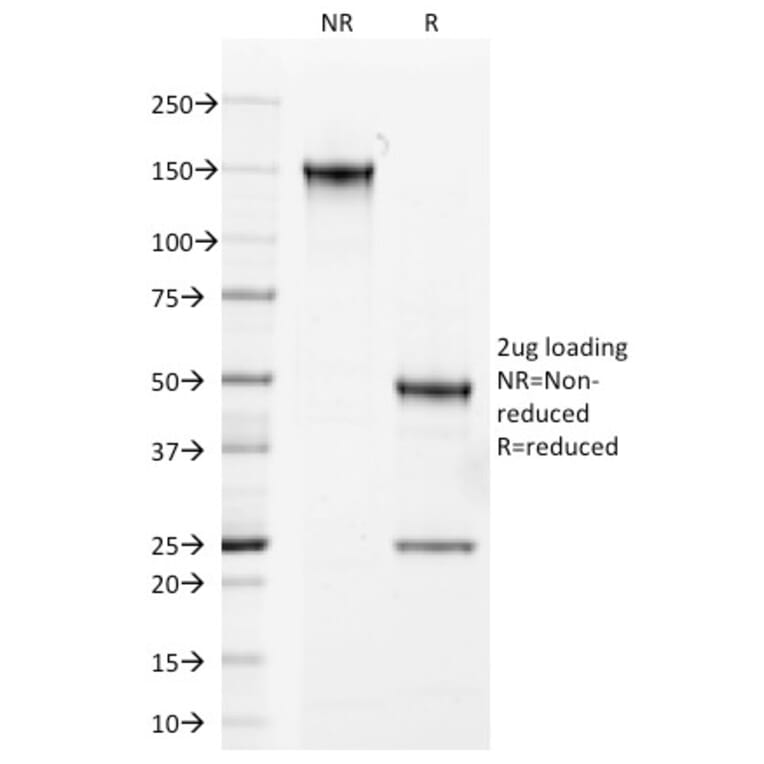 SDS-PAGE - Anti-Androgen Receptor Antibody [AR441] - BSA and Azide free (A252233) - Antibodies.com