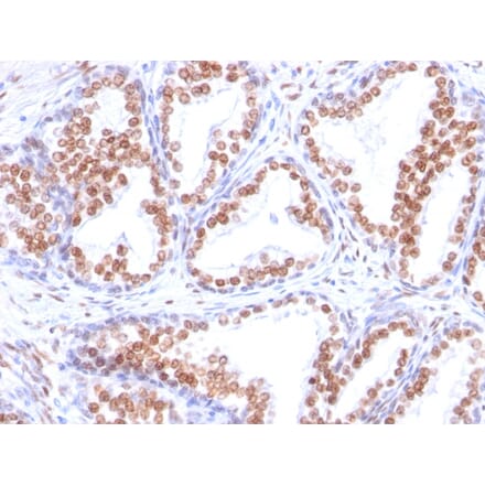 Immunohistochemistry - Anti-Androgen Receptor Antibody [DHTR/882] - BSA and Azide free (A252234) - Antibodies.com