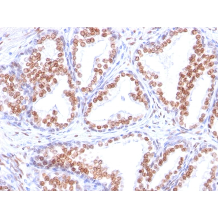 Immunohistochemistry - Anti-Androgen Receptor Antibody [DHTR/882] - BSA and Azide free (A252234) - Antibodies.com