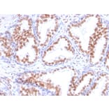 Immunohistochemistry - Anti-Androgen Receptor Antibody [DHTR/882] - BSA and Azide free (A252234) - Antibodies.com