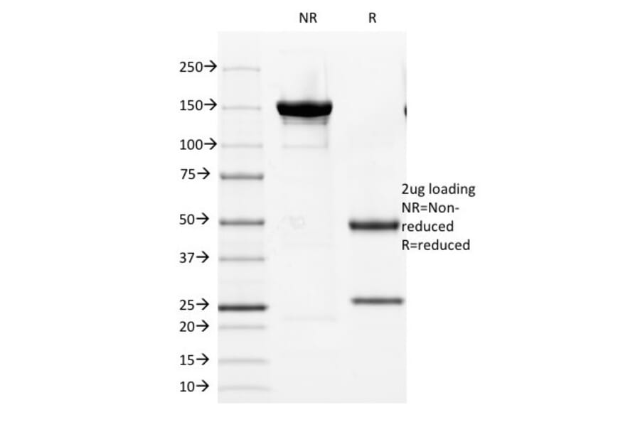 SDS-PAGE - Anti-Androgen Receptor Antibody [DHTR/882] - BSA and Azide free (A252235) - Antibodies.com